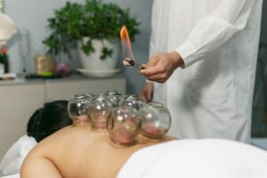 Read more about the article Hijama Is A Cure for Every Disease