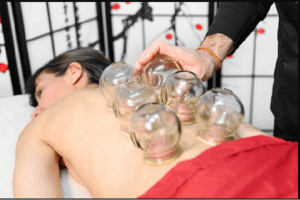 Read more about the article <strong>The Benefits of Cupping</strong>