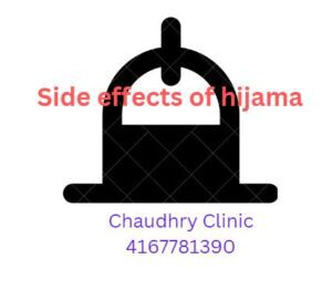 Read more about the article Side Effects of Hijama