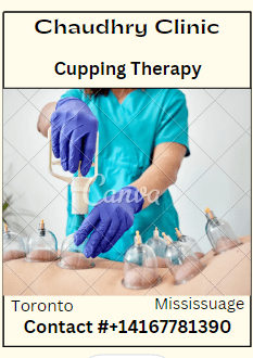 You are currently viewing Cupping Therapy